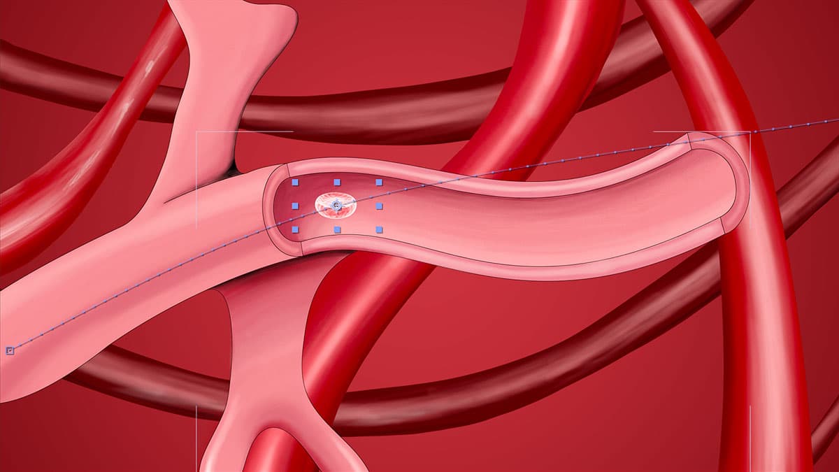 preview medical ill setup